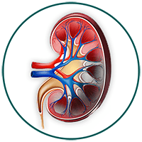 Chronic Kidney Disease (CKD)