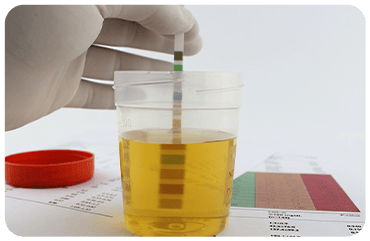 Protein in Urine