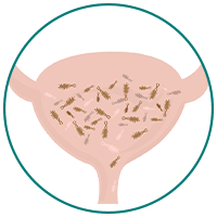 Urinary Tract Infections (UTIs)
